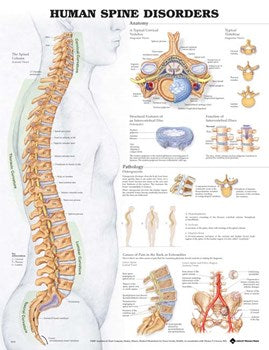ANAT Chart, Human Spine Disorders, Laminated, 20"x26"