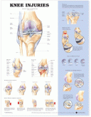 ANAT Chart, Knee Injuries, Plastic Laminate, 20"x26"