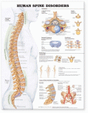 ANAT Chart, Human Spine Disorders, Styrene, 20"x26"